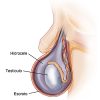 Lateral view of male genitalia showing sectioned scrotum with testis, epididymis, vas, and hydrocele.  SOURCE: 60195  MOD: Extended hydrocele to posterior side

referenced from: http://www.direct-healthcare.com/hydrocele-urology.htm
http://129.176.217.6/health/medical/IM02721